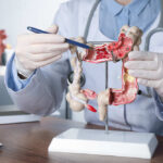 Doctor pointing at anatomical model of the colon.
