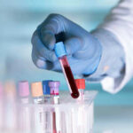 Gloved hand holding a blood sample test tube