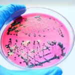 Gloved hand holding petri dish with bacterial colonies on pink agar