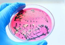 Gloved hand holding petri dish with bacterial colonies on pink agar